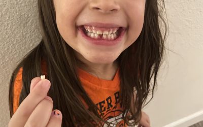 First lost tooth!! (1/4)